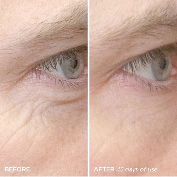 BEAUTY BIO R45 The Reversal 3 Phase Skin Transformation Treatment - Picture 9 of 14